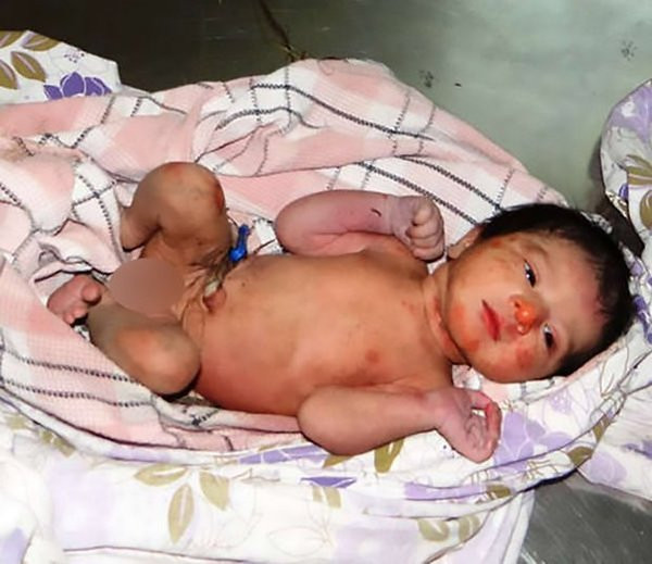 Çalıların arasına baktı bu halde buldu gözlerine inanamadı - Resim: 4