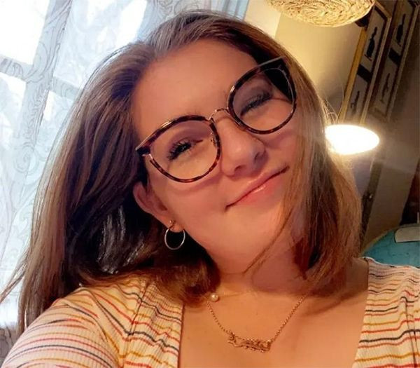 Erkek arkadaşınıza alerjiniz olabilir! Genç kadının ilginç hikayesi: Hastanelik bile oldu! - Resim: 2