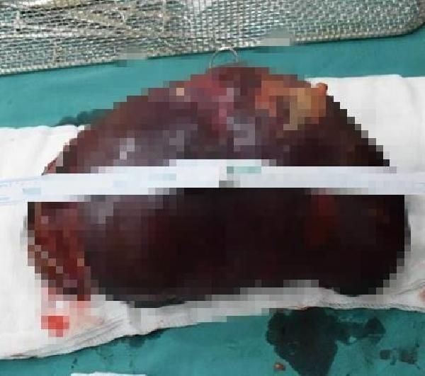 Yalova'da kargoda kaybolan dalak için şaka gibi ceza - Resim: 2