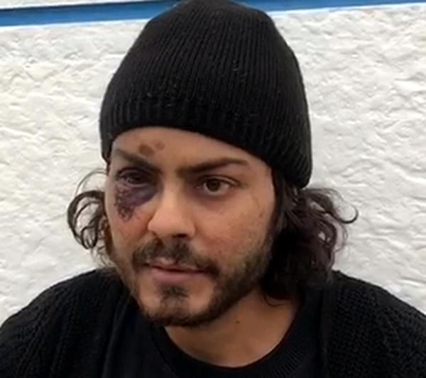 Mültecilere Yunan işkencesi askerler demir çubuklarla dövdü - Resim: 3