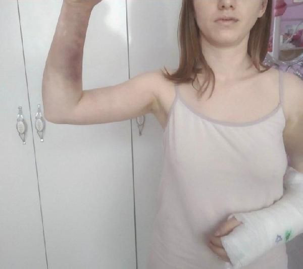 Sevgilisini 'niye bu fotoğrafı beğendin' diye beyzbol sopasıyla hastanelik eden cani tutuklandı - Resim: 4