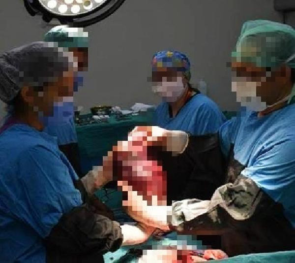 Patolojiye gönderilen organı kayboldu! 'Dalağım nerde?' diyerek suç duyurusunda bulundu - Resim: 1