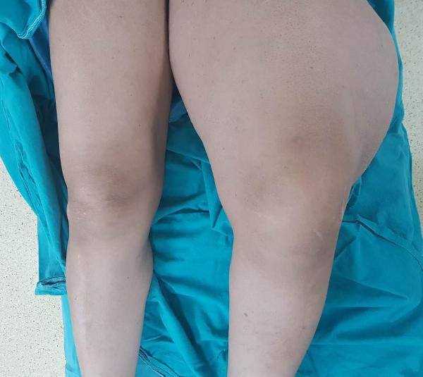 Diyarbakır'da covid-19'dan korktu doktora gidince şok oldu! 4,5 saat sürdü - Resim: 1