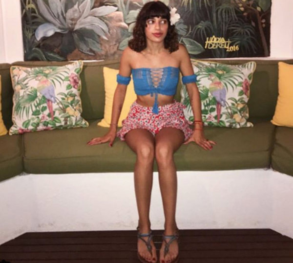 Lidya Özdemiroğlu dudaklarındaki dolguyu eritti! - Resim: 2