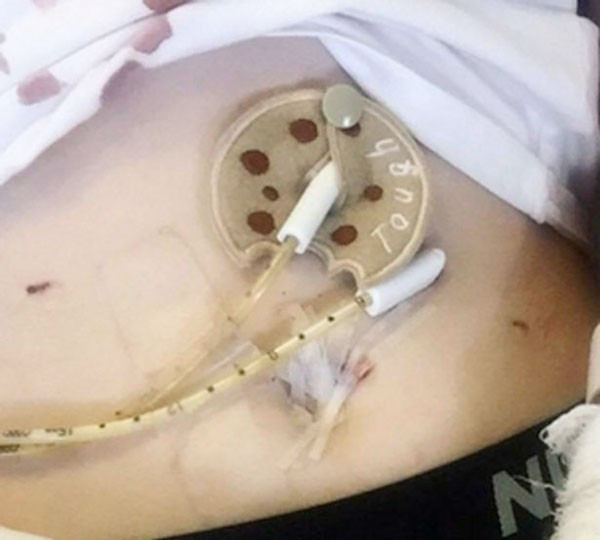 1 yıldır hiçbir şey yemiyor bakın neden - Resim: 4