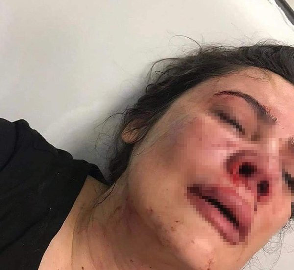 İstanbul'da eş dehşeti: "Ensendeyim, yaşamın ve ölümün elimde" - Resim: 0