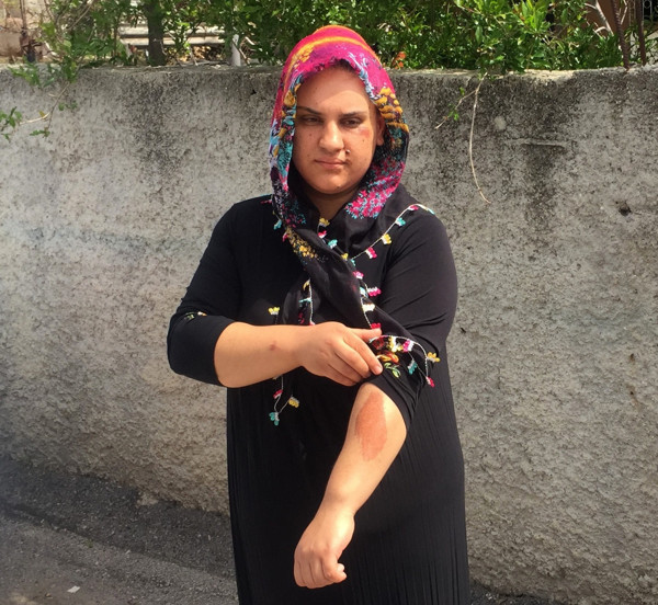 Adana'da 'bu bir canilik' deyip sokakta yaşadığı dehşeti anlattı: Görünce şüphelendim - Resim: 1