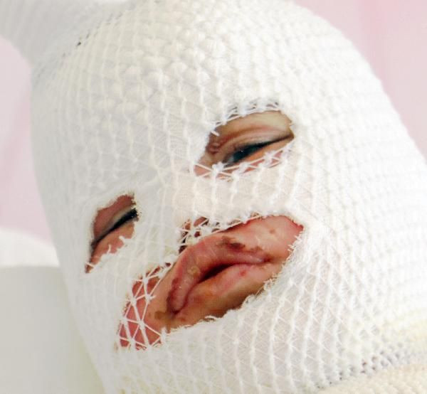 Konuşamıyor sadece ağlıyor! Kars'ta feci olay sonrası mumyaya döndü - Resim: 1