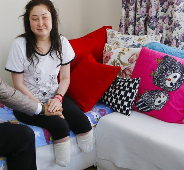 Estetik ameliyat sonrası felaket! Burun ameliyatı oldu bacakları kesildi - Resim: 2