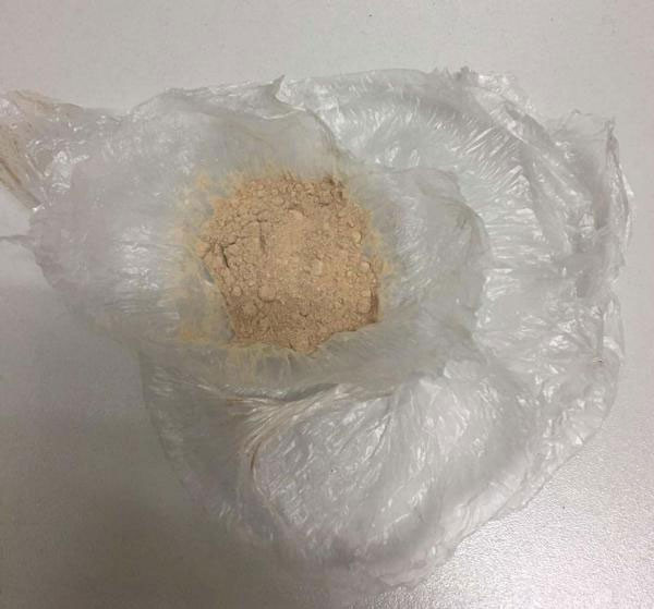 Cinsel organından öyle bir şey çıktı ki...İnanılır gibi değil - Resim: 4