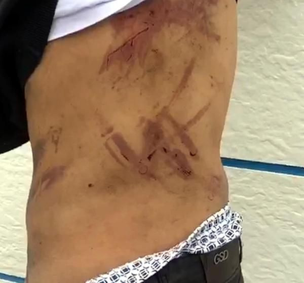 Mültecilere Yunan işkencesi askerler demir çubuklarla dövdü - Resim: 4