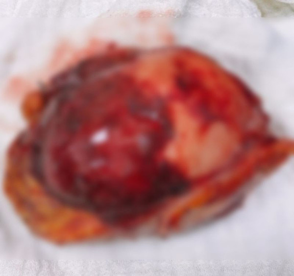 Kahramanmaraş'ta karın ağrısıyla gitti 2,5 saatte çıkarıldı! Doktorlar şaştı kaldı - Resim: 1