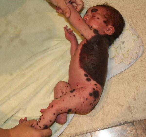 Bebek bu halde doğdu anne baba şoke oldu gerçekler ortaya çıkınca... - Resim: 3