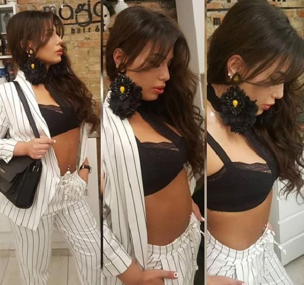 22'nci kez estetik ameliyatı oldu kadınlara mesaj yolladı - Resim: 2