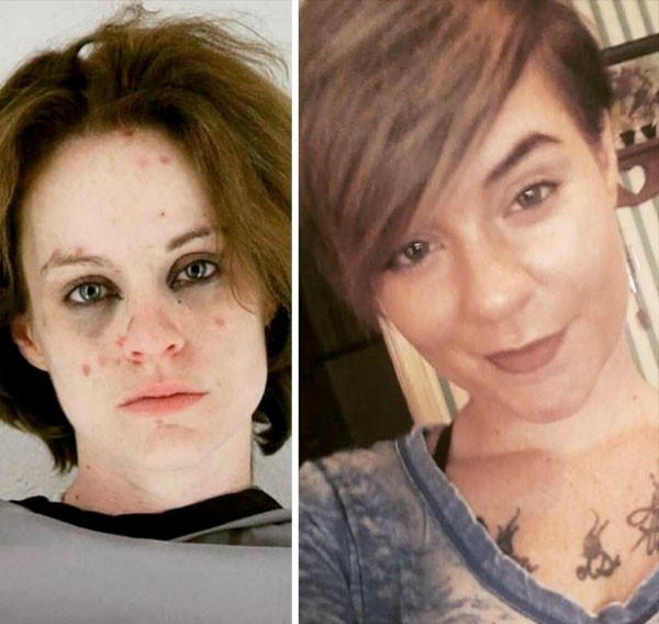 Uyuşturucudan bu haldeydi şimdi bambaşka! - Resim: 2