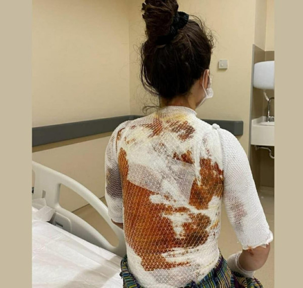 Konya'da kahvaltı yaparken hayatının şokunu yaşadı: Beni banyoya... - Resim: 2