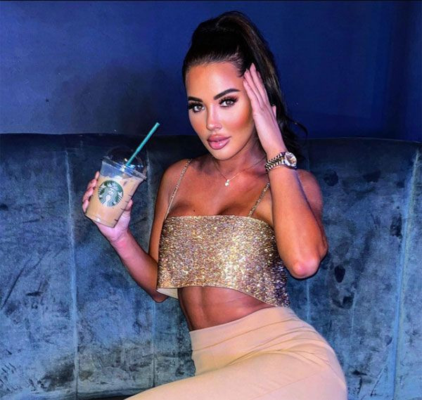 Bodrum'da kaza yapmış ağır yaralanmıştı! Ünlü model korkunç kazanın detaylarını anlattı "Bilerek kolumu kırdım" - Resim: 1