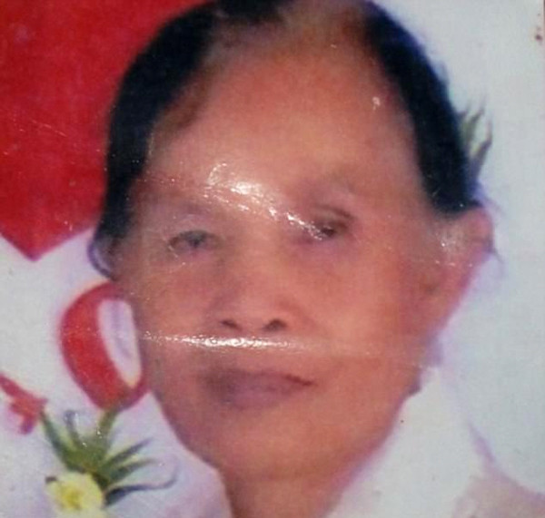 Yaşlı kadın iki yıl içerisinde bu hale geldi gören kaçıyor ama... - Resim: 1