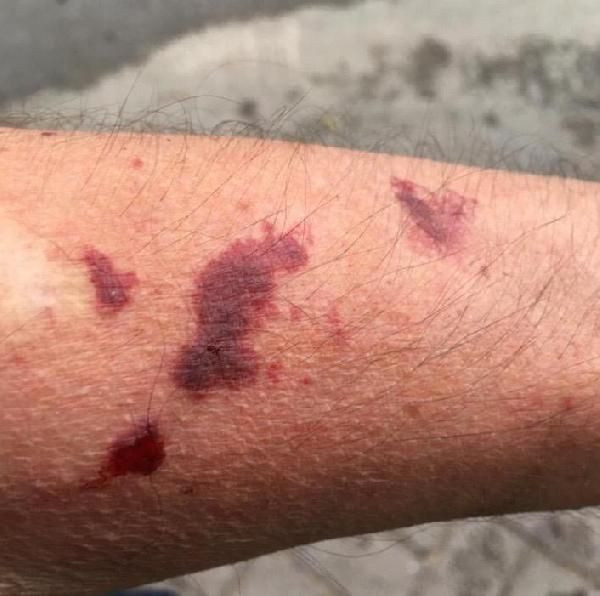 Sapanca'da Asya kaplan sivrisineği paniği yaşanıyor! Her yerdeler - Resim: 1