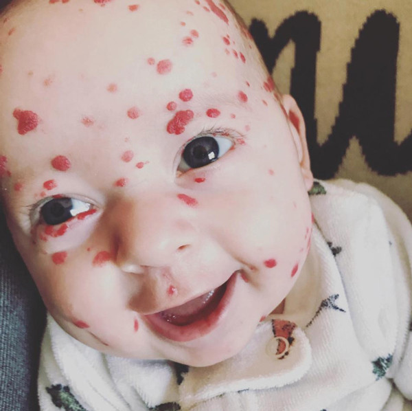 Doktorları bile hayrete düşürdü görenler korkup kaçıyor ama... - Resim: 1