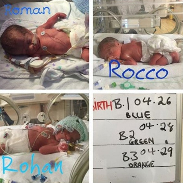 Üçüz bebekler için hastaneye yetiştiler ama doktor inanamadı - Resim: 3