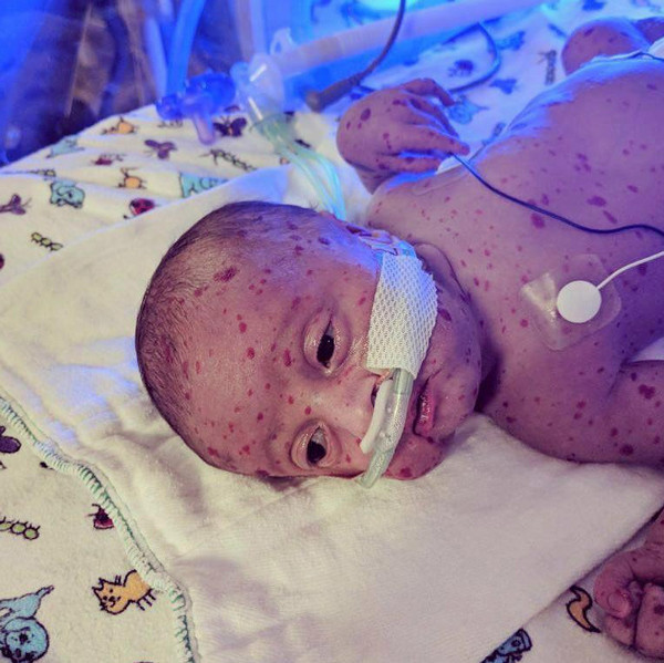 Doktorları bile hayrete düşürdü görenler korkup kaçıyor ama... - Resim: 2