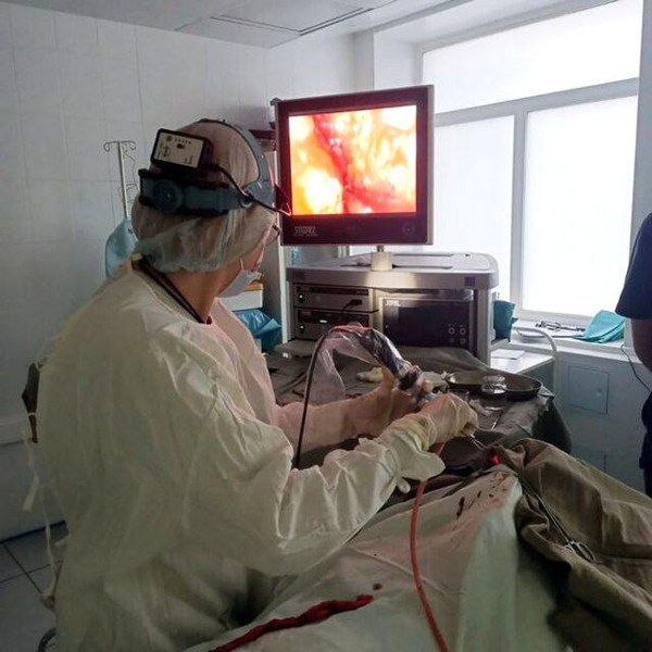 59 yaşındaki adam yıllardır nefes alamıyordu! Burnundan çıkan şey doktorları şok etti - Resim: 0