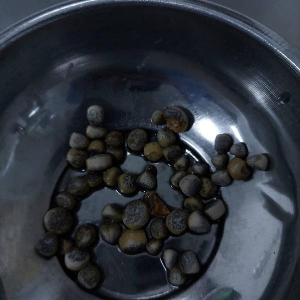 Aksaray'da oturamayacak hale geldi! Doktora gidince şok oldu: 50 tane... - Resim: 1