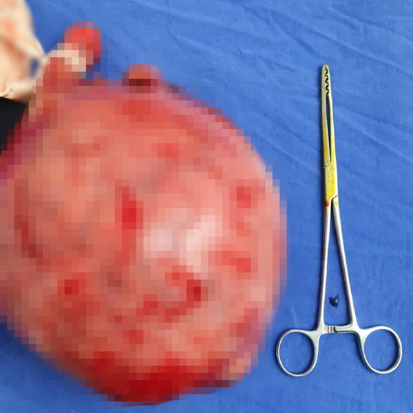 Samsun'da ağrıyla hastaneye gitti doktorlar şaştı kaldı: Geceleri hep yan yatardım - Resim: 0