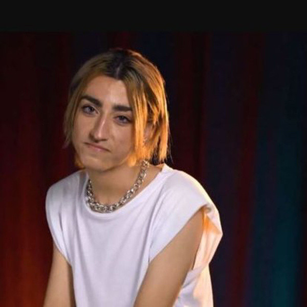 Estetikle bambaşka biri olmuştu! Mika Raun'un cinsellik sorusuna verdiği cevabı duyanlar kulaklarına inanamadı - Resim: 0