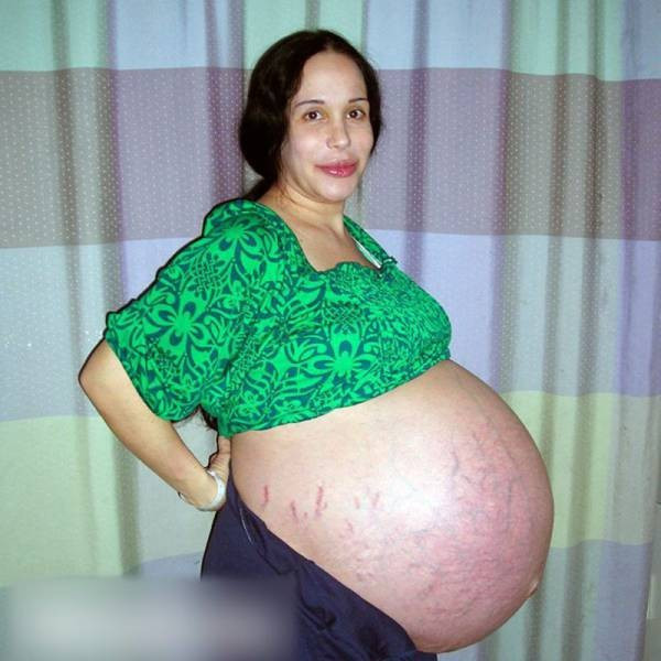 Onu hatırladınız mı? Son haline bakın - Resim: 1