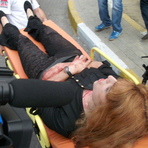 Sultangazi canisi böyle  görüntülendi! - Resim: 3