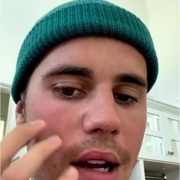 Yüz felci geçiren Justin Bieber'in son hali sevenlerini korkuttu dua istedi - Resim: 3