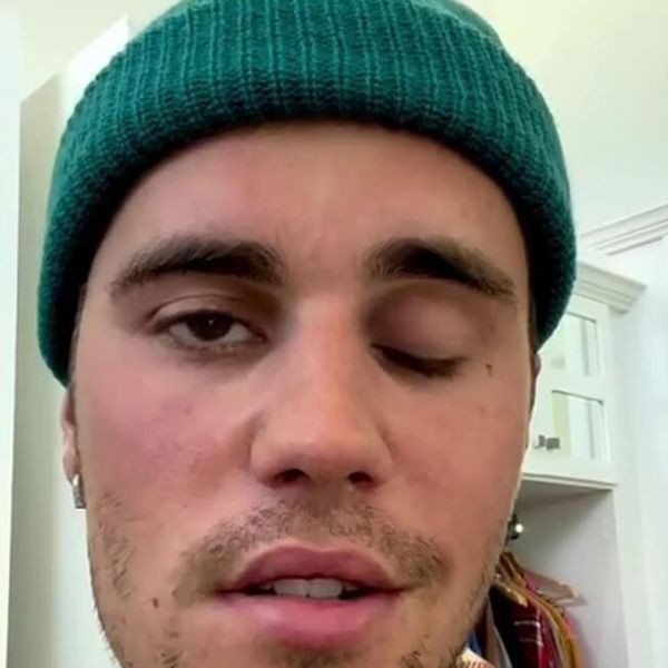 Yüz felci geçiren Justin Bieber'in son hali sevenlerini korkuttu dua istedi - Resim: 4