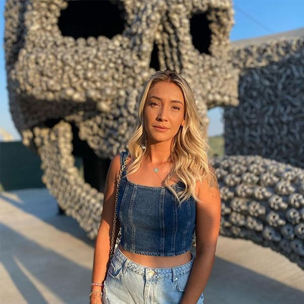 Survivor Evrim Keklik korkuttu! Mini şort giydi bacağındaki o.... - Resim: 1