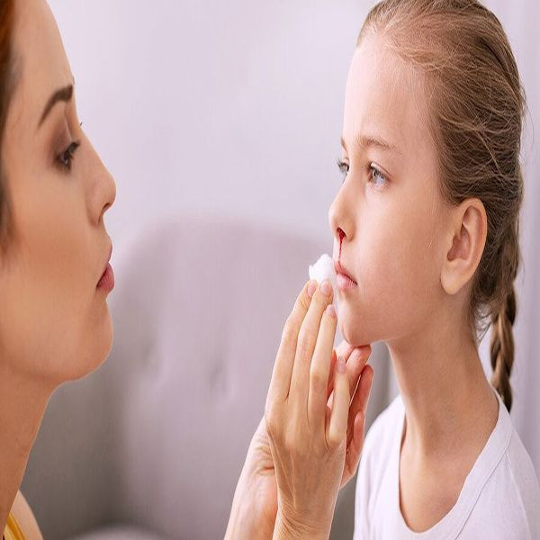 Yaz aylarının korkulu rüyası burun kanamasına aman dikkat! Nedeni bambaşka olabilir - Resim: 3