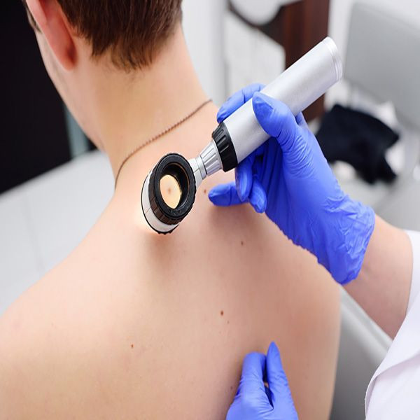 Sosyal medyadan aldığınız cilt ürünleri hayatınızı karartabilir! "Kanser tanısı koyulmasını geciktiriyor" - Resim: 2