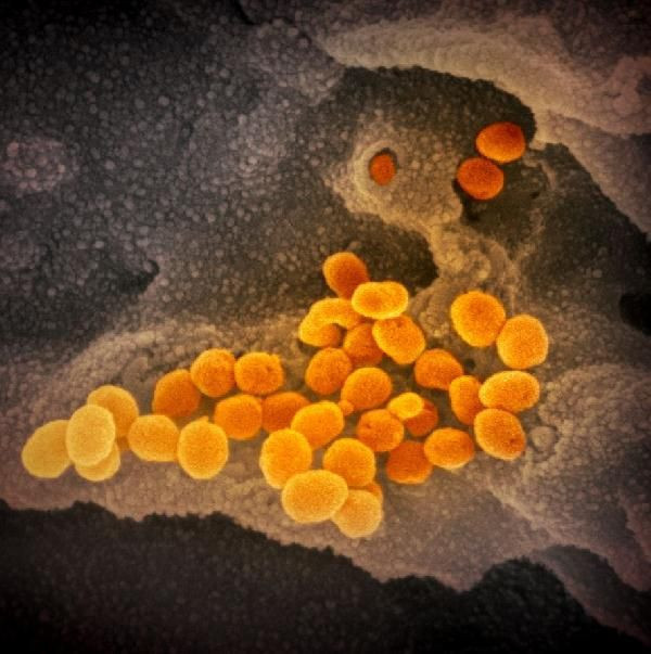 Covid-19 yani koronavirüs ilk kez görüntülendi sebebi bakın neymiş - Resim: 2