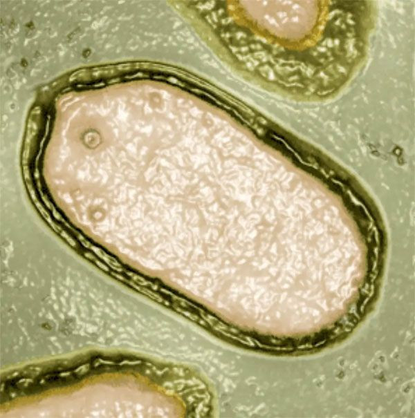 Sibirya'da zombi virüs bulundu 48 bin 500 yaşındaki virüs canlandı Covid'i aratacak salgın... - Resim: 2