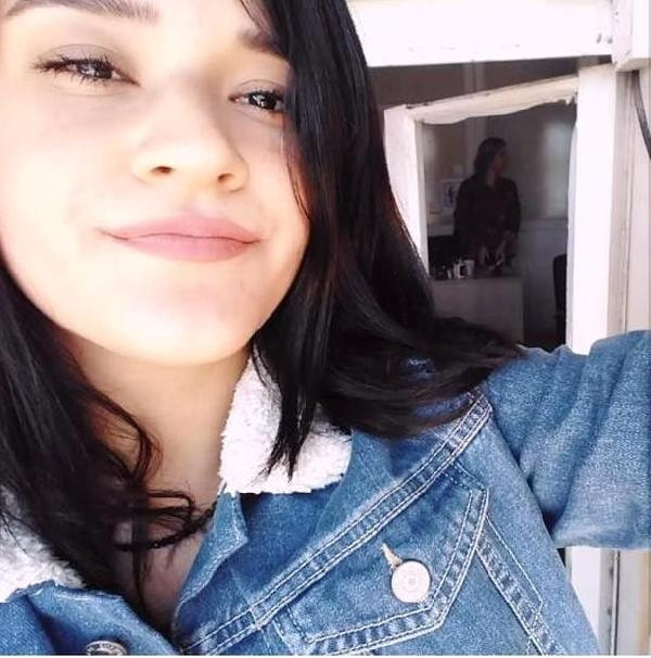 Hatay'da yüzü yakılan  Berfin Özek'ten kötü haber! Gözünü kaybedebilir - Resim: 2