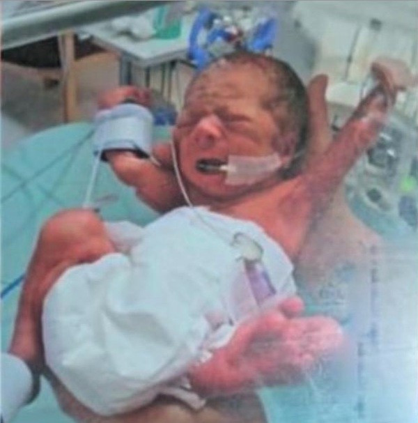 Doğuştan hastalığı vardı hemşire hayalini duydu ve... - Resim: 2