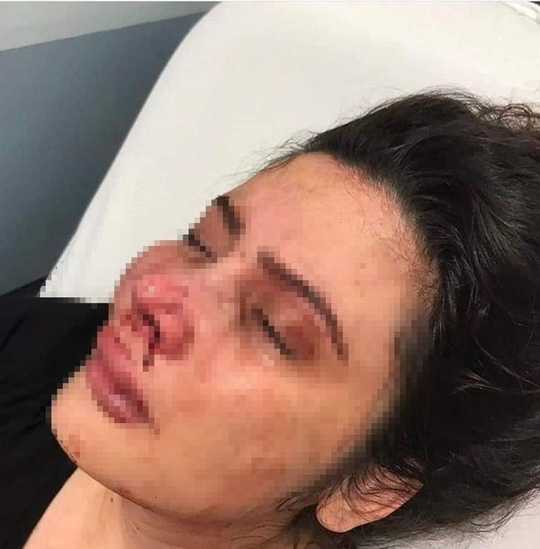 İstanbul'da eş dehşeti: "Ensendeyim, yaşamın ve ölümün elimde" - Resim: 2