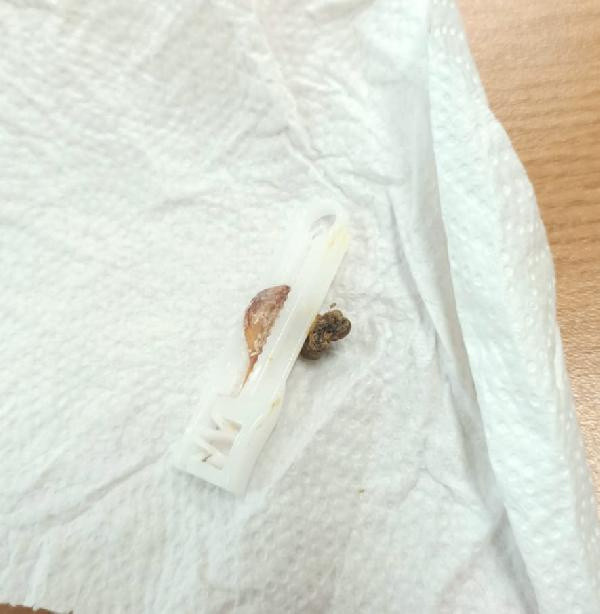 Şanlıurfa'da masada görünce bahçeye gömdü: İlk kez böyle bir şey oldu - Resim: 1