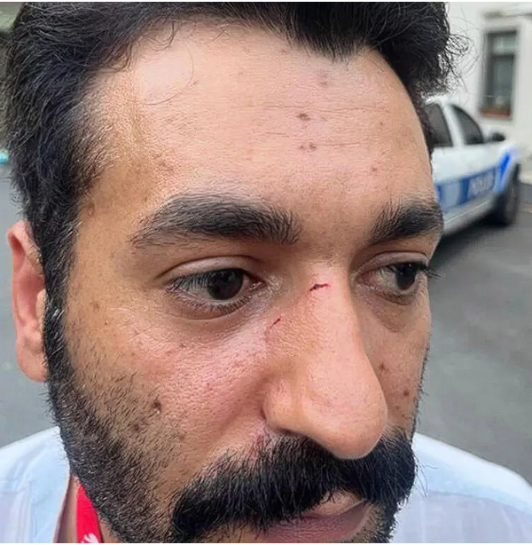 5 kadınla birlikte görüntülenince! Eski Beşiktaşlı Fernandes gazeteciyi yumrukladı - Resim: 2