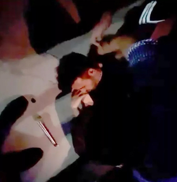 Ünlü popçu sahneden düştü, olanlar oldu! Hastaneye kaldırılan Emre Kaya'dan hayranlarını üzen haber - Resim: 2