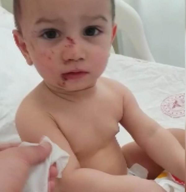 İstanbul'da 2 yaşındaki çocuk 6. kattan düştü mucize şekilde kurtuldu! - Resim: 3