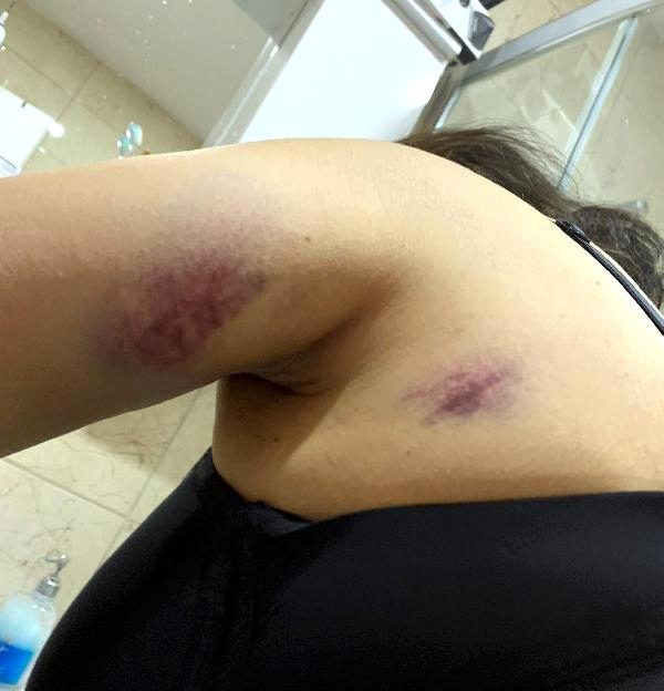 Ormana kaçırdı, dövdü, işkence yaptı: Ya benimsin ya ölekecsin - Resim: 2