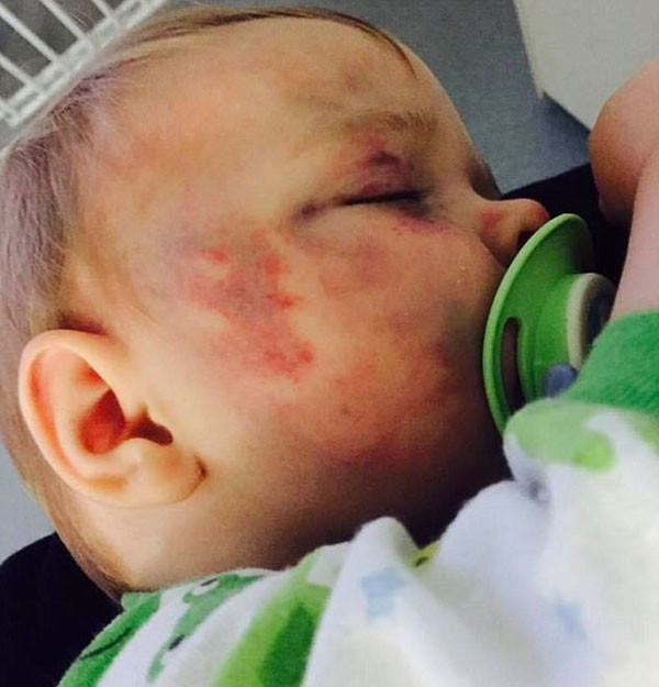 Vicdansız anne bebeğini kendi elleriyle bu hale getirdi sonrası korkunç - Resim: 3