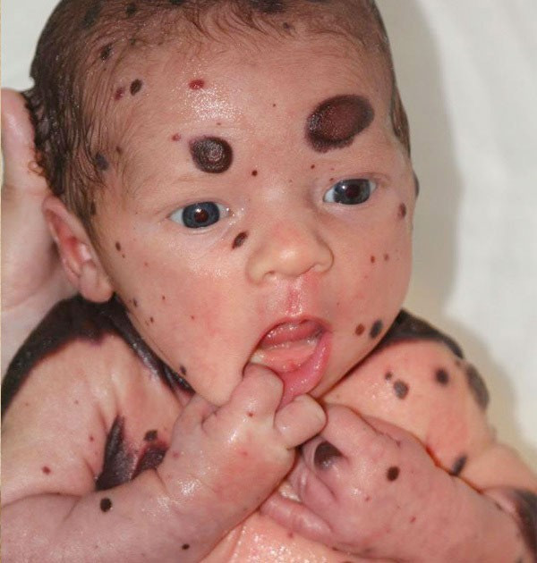 Bebek bu halde doğdu anne baba şoke oldu gerçekler ortaya çıkınca... - Resim: 2