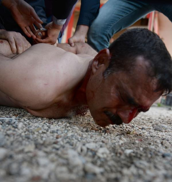 Polisi görünce kendine bunu yaptı! - Resim: 4